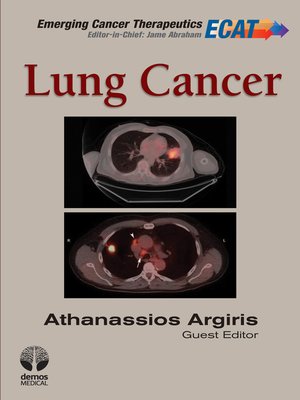 cover image of Lung Cancer